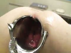 Извращенец увеличил очко девочки при помощи анального расширителя