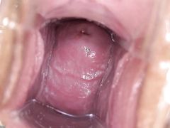 Фанатка жести показала матку крупным планом при помощи расширителя пизды